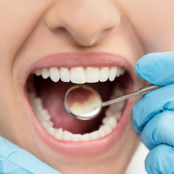 close up of dentist looking at womans teeth with mirror